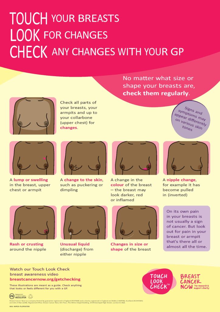 A graphic illustration of breast symptoms to look out for